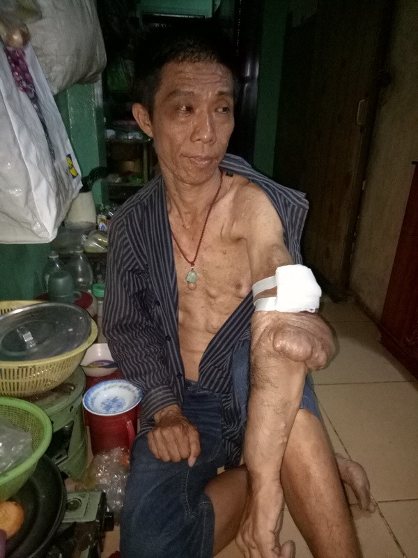 盧志海期待入院施手術。