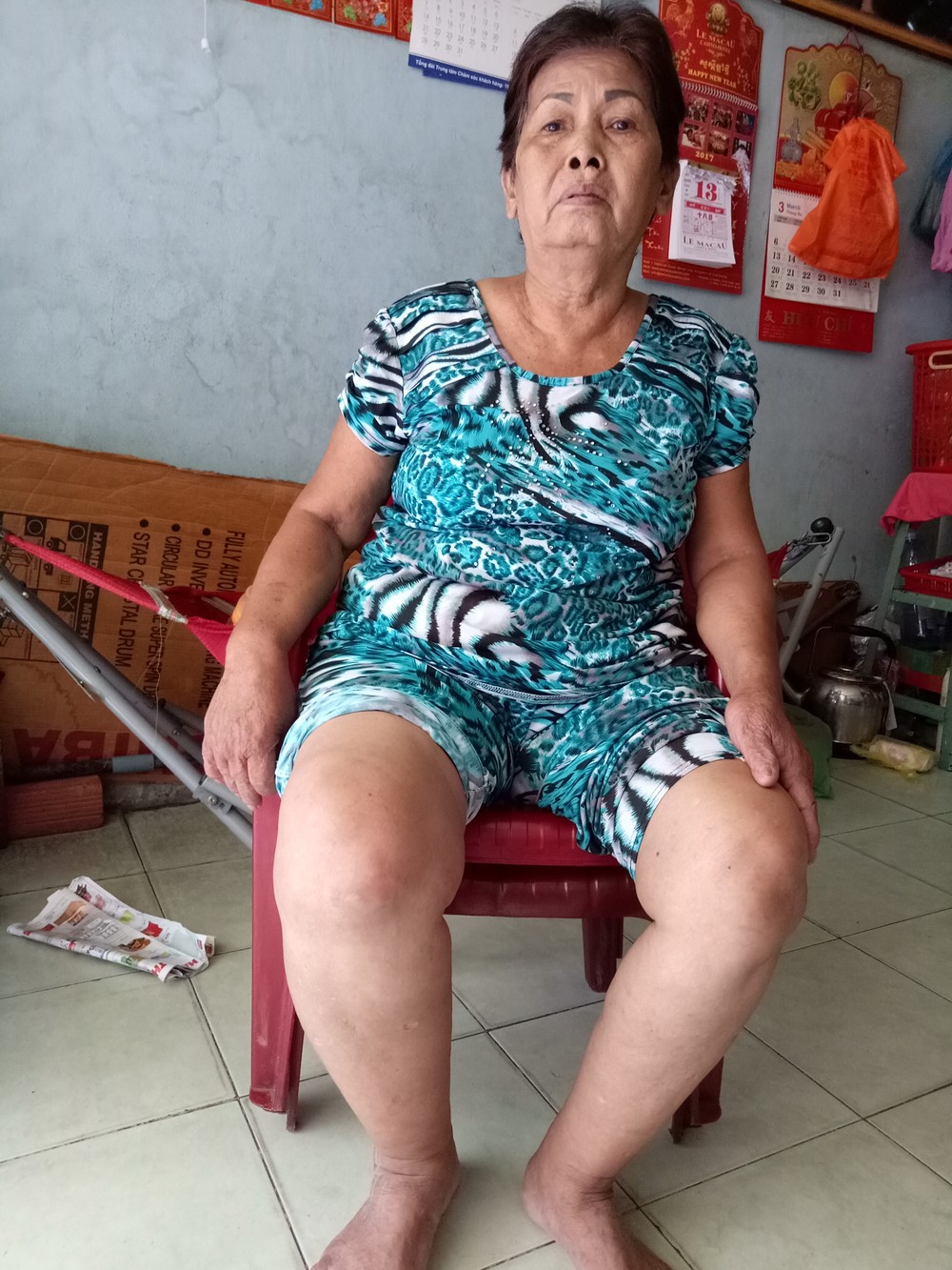 陳阿嬌的腰骨疼痛，腳部浮腫。