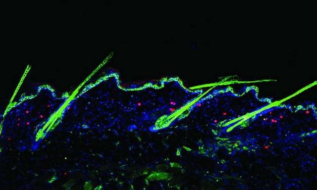 調節性T細胞（紅色）參與毛髮（綠色）的生長。（圖片來源：論文）