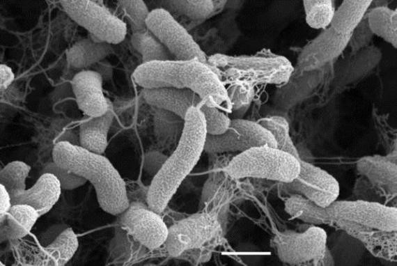 掃瞄電鏡下的霍亂弧菌。（圖片來源：www.rki.de）