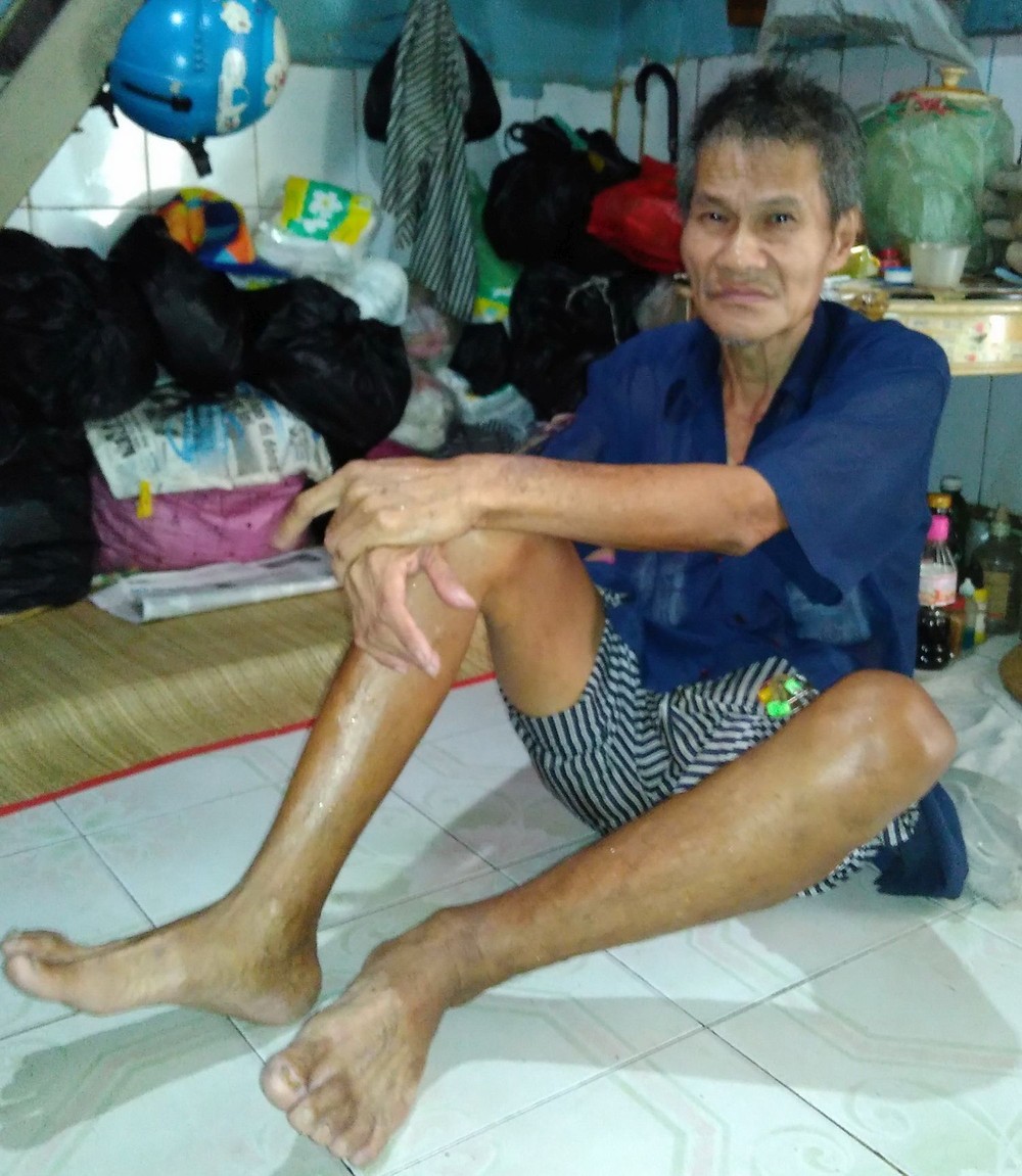 不幸患了疾病的蘇志強。