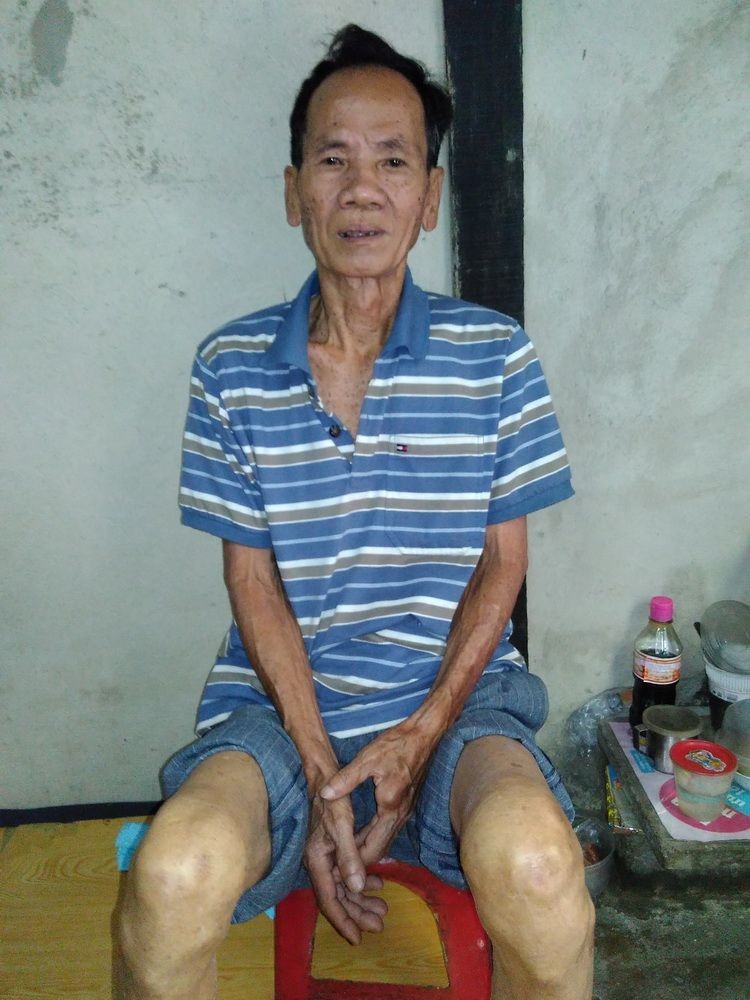 劉明天天都希望可以動手術。