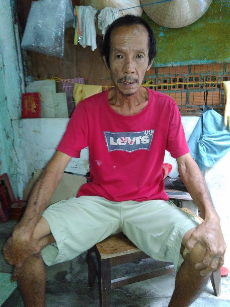 文光平多年來未能治癒膽結石病。