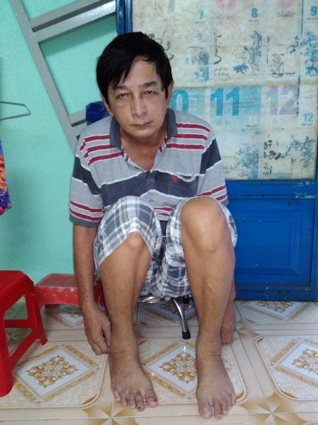 劉勳自從中風之後神經衰弱。