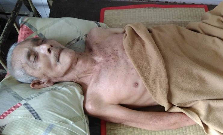 潘錦喜中風後失去自理能力。