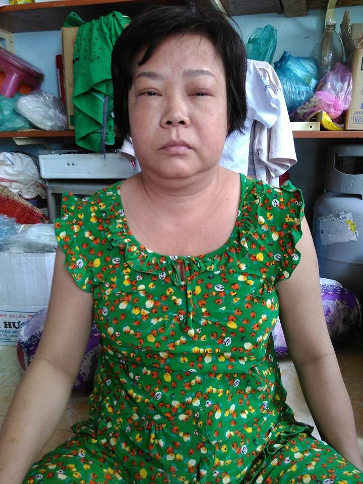 鍾寶絲家境貧困又不幸受了重傷。