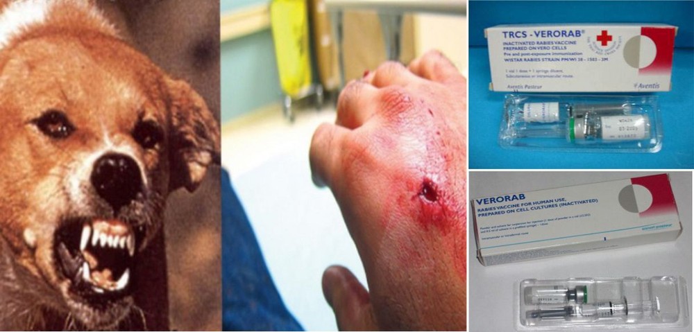 狂犬病疫苗短缺。（示意圖源：互聯網）