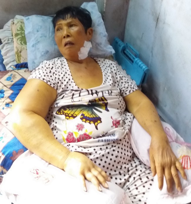 陳王大娘病情日益加重，身體很衰弱。