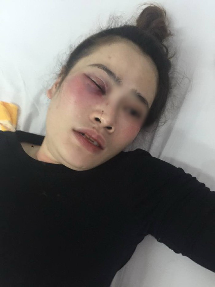 傷者陳氏瓊茹當前還在住院接受治療中。（圖源：金塋）