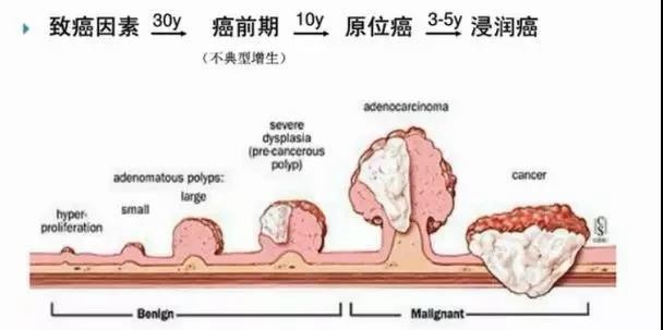 結腸息肉約30年演變為癌前病變，5-10年演變為癌症，後浸潤、轉移