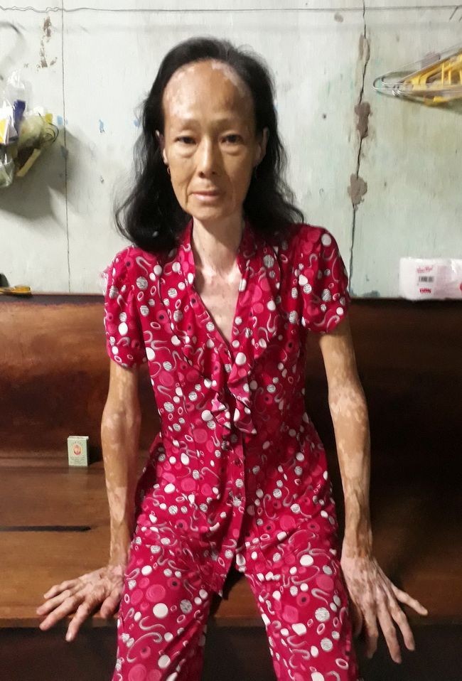 王氏雁在家養病。