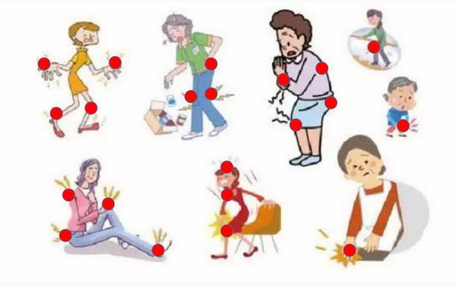 風濕性關節炎併發症有哪些？（示意圖源：互聯網）