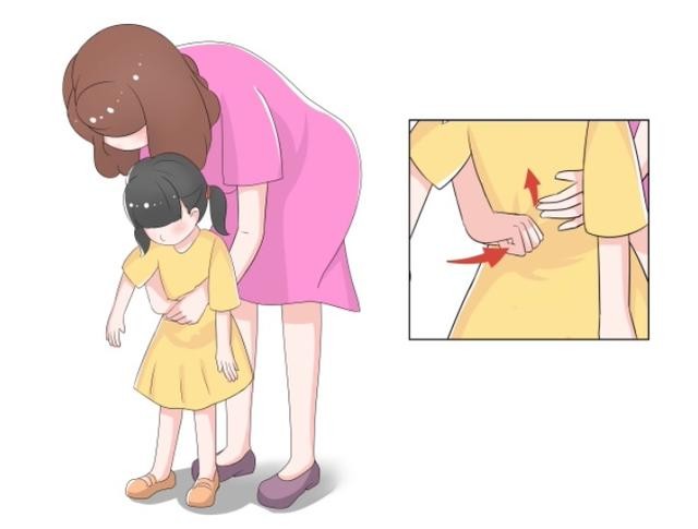 1歲以上的兒童：腹部手拳連續衝擊6~8次。（圖源：互聯網）