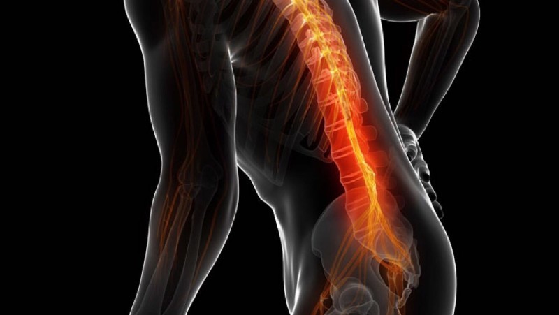 便秘竟是腰椎間盤突出所致。（示意圖源：互聯網）