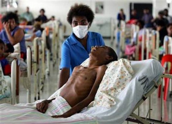 聯合國愛滋病規劃署：愛滋病毒感染者死於結核病人數仍偏高。（示意圖源：互聯網）