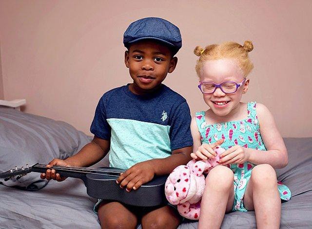 黑皮膚的男嬰卡姆西和白皮膚的女嬰卡奇。（圖源：CNA）