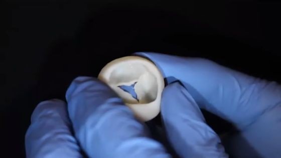美國科學家們成功以膠原蛋白為原料，用3D生物印表機作出能在人體運作的心臟瓣膜。（圖源：Carnegie Mellon University ）