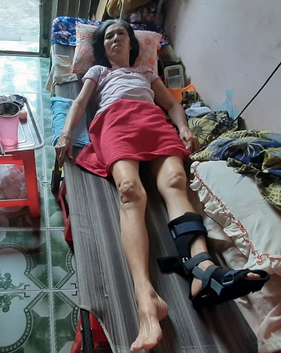 馮燕好斷了腳腕骨，亟需治療。