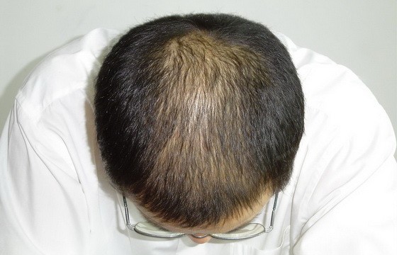 （示意圖源：互聯網）