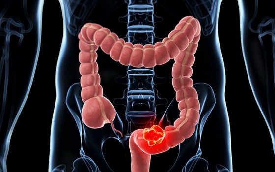 （示意圖源：互聯網）