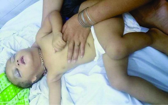 兩歲的小孩受重傷。（圖源：陳常）