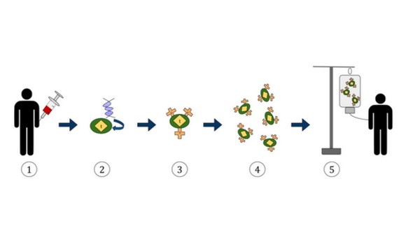 嵌合抗原受體 T 細胞免疫療法流程圖。
