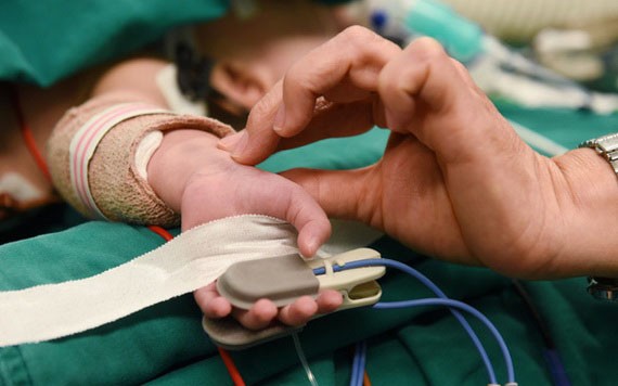 連體嬰接受分離手術12個小時後生命體征基本平穩。（圖源：緣潘）