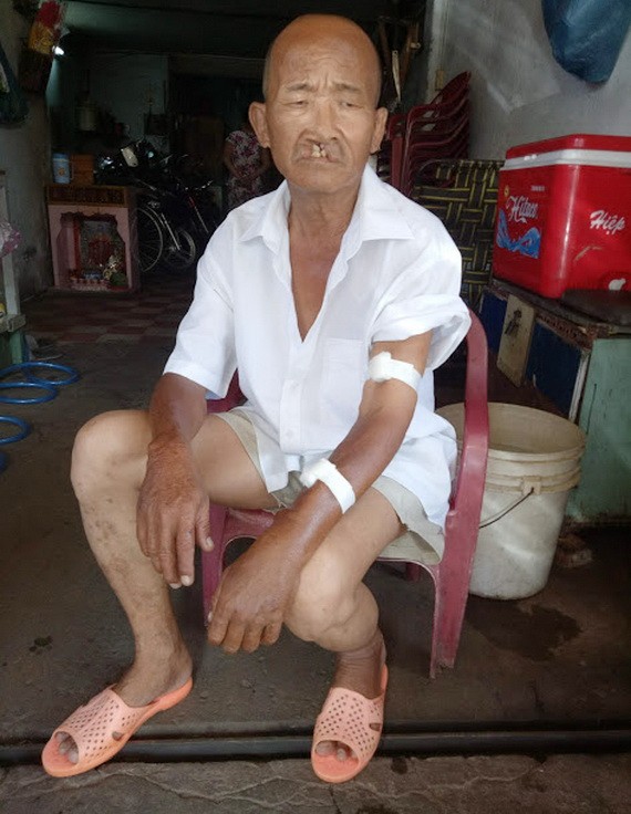 林偉山多年來受腎病折磨。