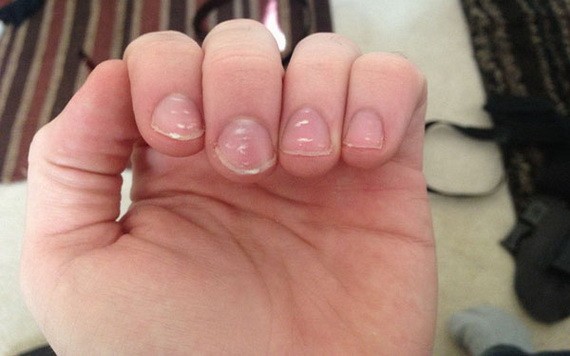 （示意圖源：互聯網）