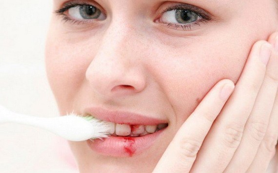 （示意圖源：互聯網）