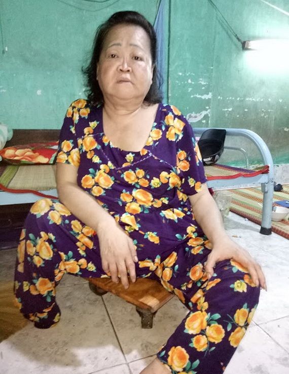 患小兒麻痹症的蔡玉蝶不良於行。