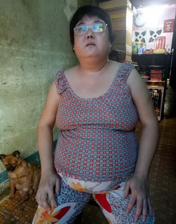 盧玉娟的下腹皮膚嚴重紅腫、 破裂。