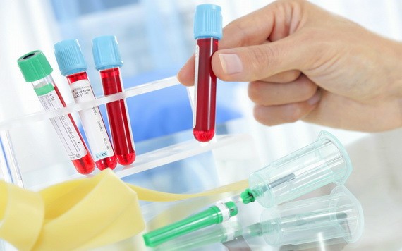 （示意圖源：互聯網） 