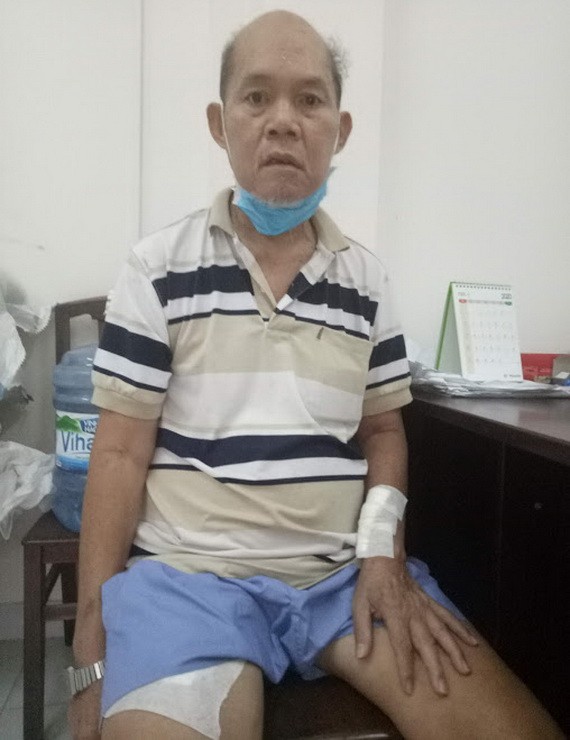 陳蘇蝦的手及大腿需要動手術以方便洗腎。