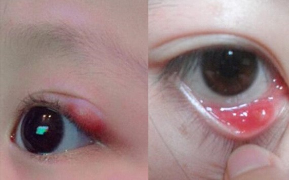 （示意圖源：互聯網） 