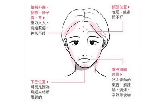 青春痘長在哪，看出你的身體警訊！