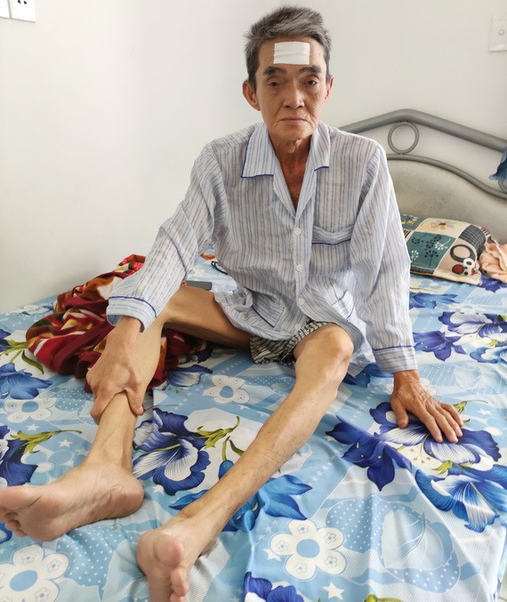 周福業患癌症後瘦骨如柴。