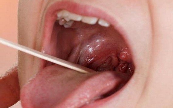 （示意圖源：互聯網） 