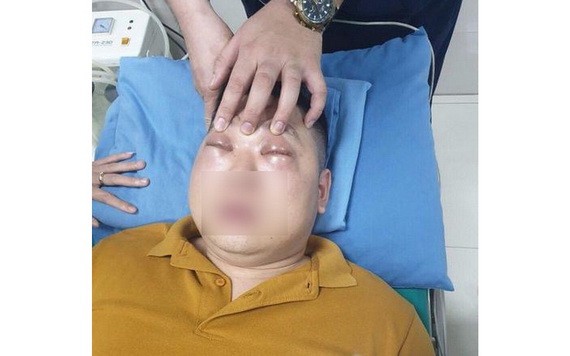 因切洋蔥不巧誘發過敏性休克的男子。（圖源：院方提供）