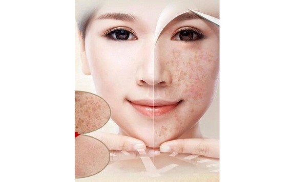 （示意圖源：互聯網） 