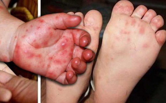 （示意圖源：互聯網） 