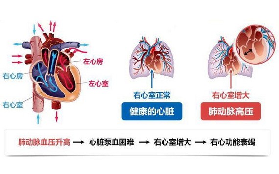 （示意圖源：互聯網） 