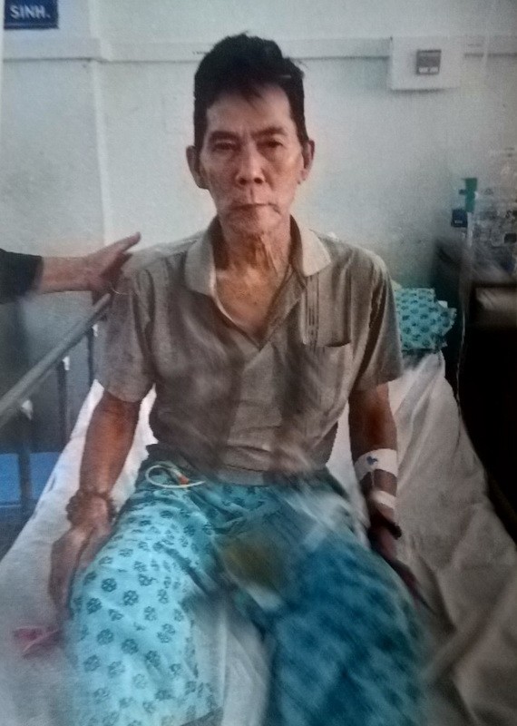 姜凱姜要隨身攜帶尿袋。