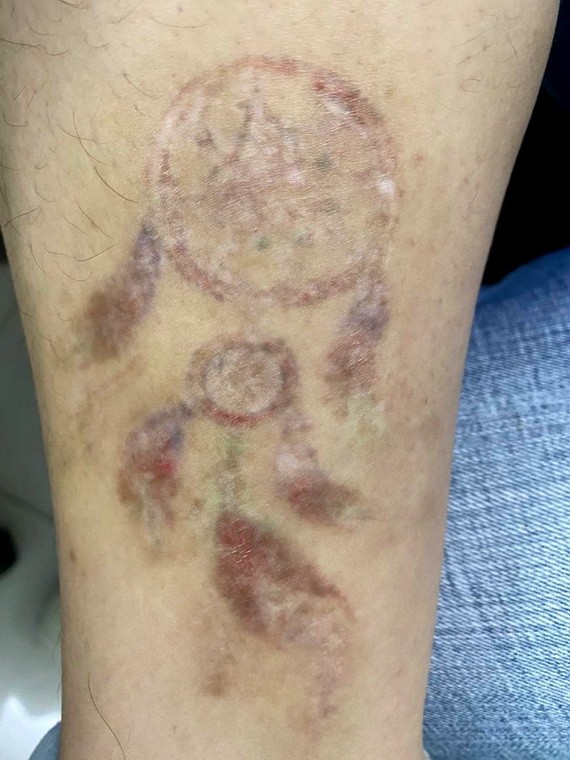 不少學生盲目紋身，之後懊悔不已。