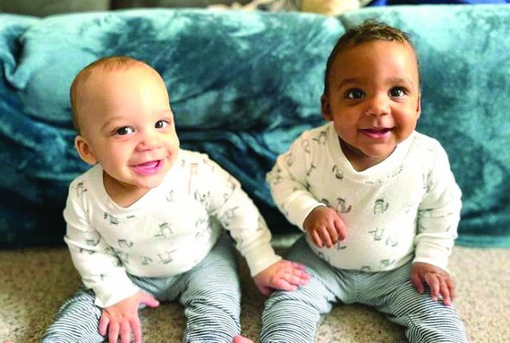 美夫妻生育一黑一白雙胞胎