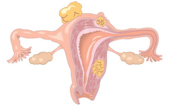 卵巢“年齡”有多大？保養要注意４個階段