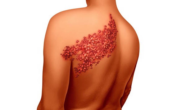 “纏腰龍”頭尾相接，真的會要命麼？