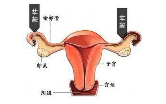 導致附件炎５大元兇要謹防！