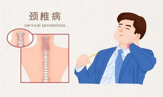 頸椎病術後不能大意