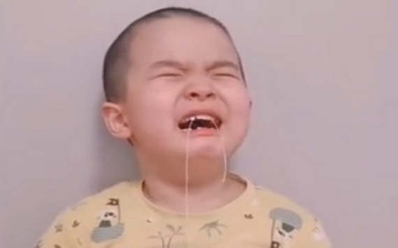 在支氣管找到小孩乳牙